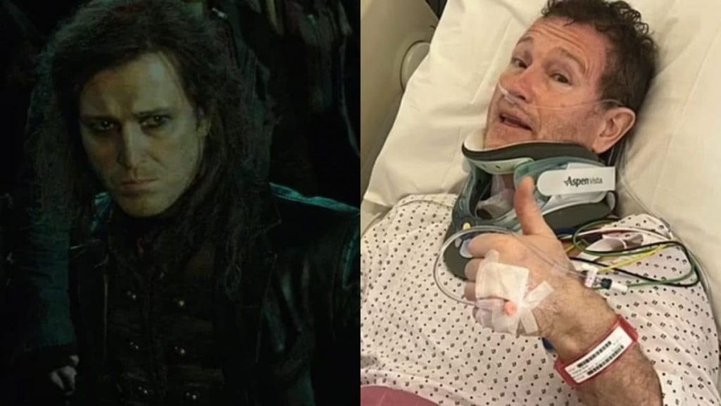 Harry Potter Actor Nick Moran Undergoing Urgent Surgery In Icu
