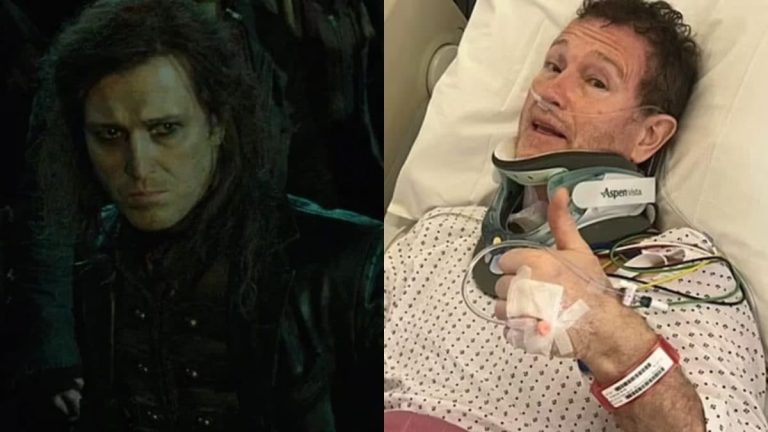 Harry Potter Actor Nick Moran Undergoing Urgent Surgery In Icu